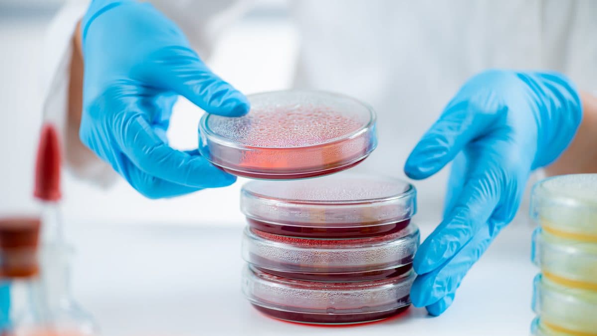 Petriho miska s bakteriální kulturou v laboratoři