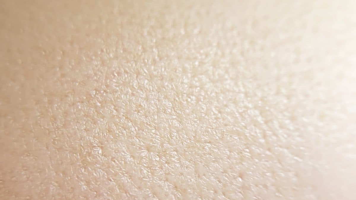 Detail struktury pleti a pórů