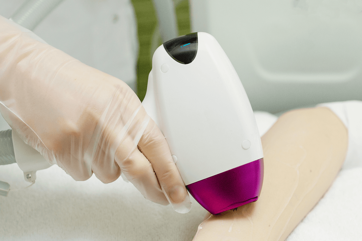 Aplikace laserové epilace Detail laserové hlavice přiložené k pokožce nohy s gelem