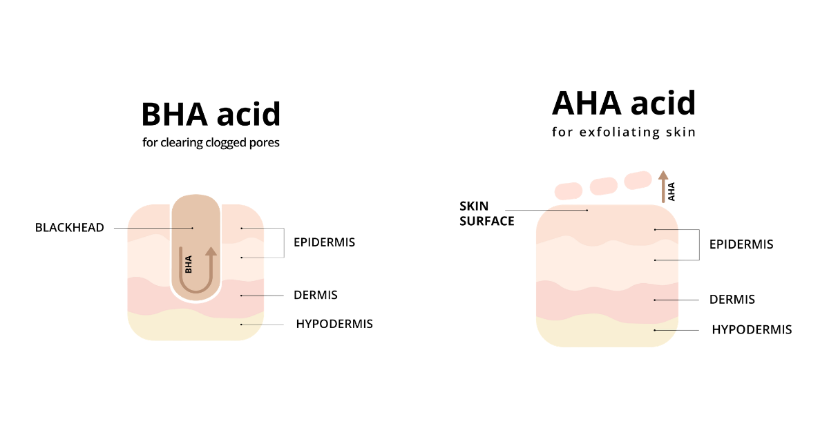 Srovnání AHA a BHA kyseliny – infografika s rozdíly v působení na pokožku